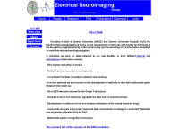 electrical-neuroimaging.ch