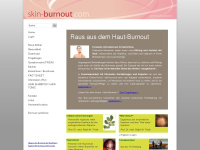 skin-burnout.ch